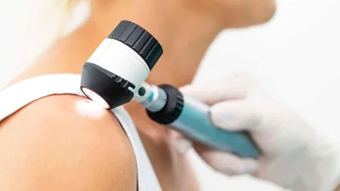 Does Having Multiple Skin Cancers Increase Your VCF Award?
